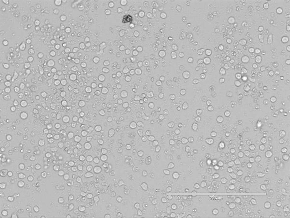 Picture1-3 CRISPR/CAS9 in CD34+ cells