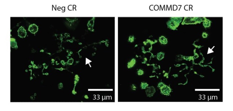 Picture1-4 Megakaryocyte phenotypic and platelet function assays