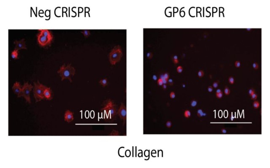 Picture1-5 Megakaryocyte phenotypic and platelet function assays